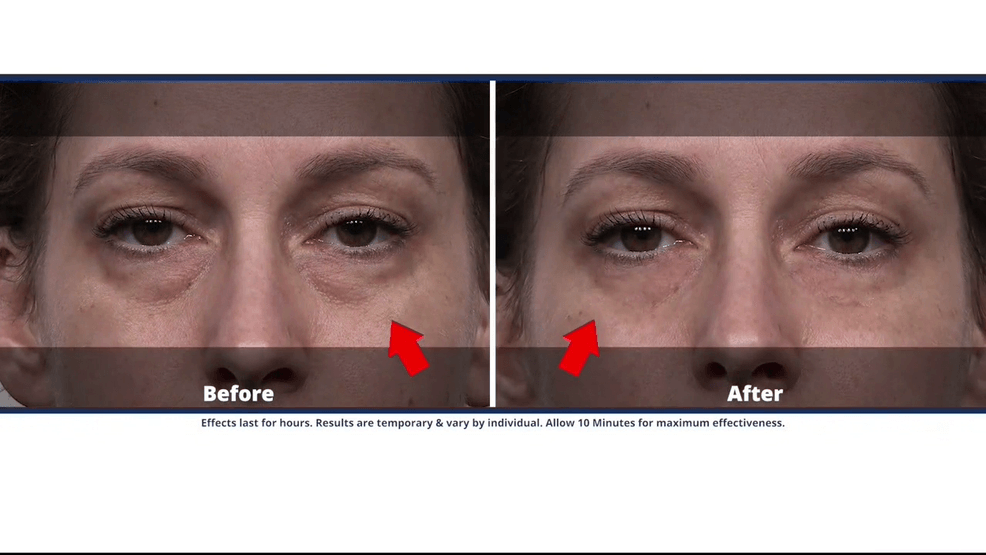 Image for story: Let Plexaderm Help Your Skin